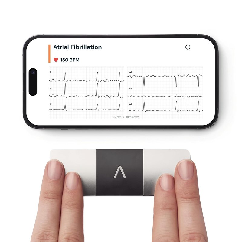KardiaMobile 6-Lead Personal ECG Heart Rate Monitor - Detects Atrial Fibrillation, Trusted by the NHS, Results in 30 Seconds, Works with Most Smartphones, Supporting British Heart Foundation